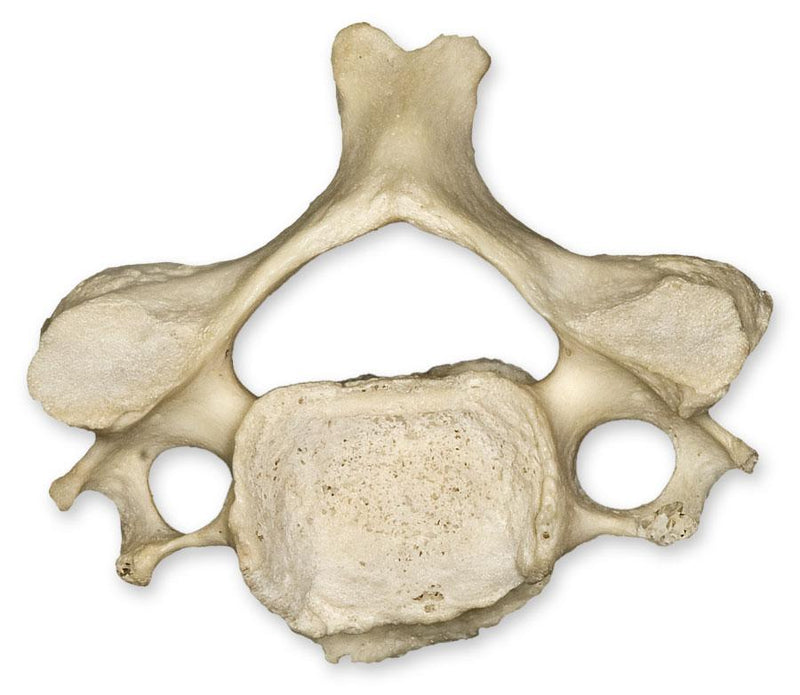 Real Human Cervical Vertebra - Single